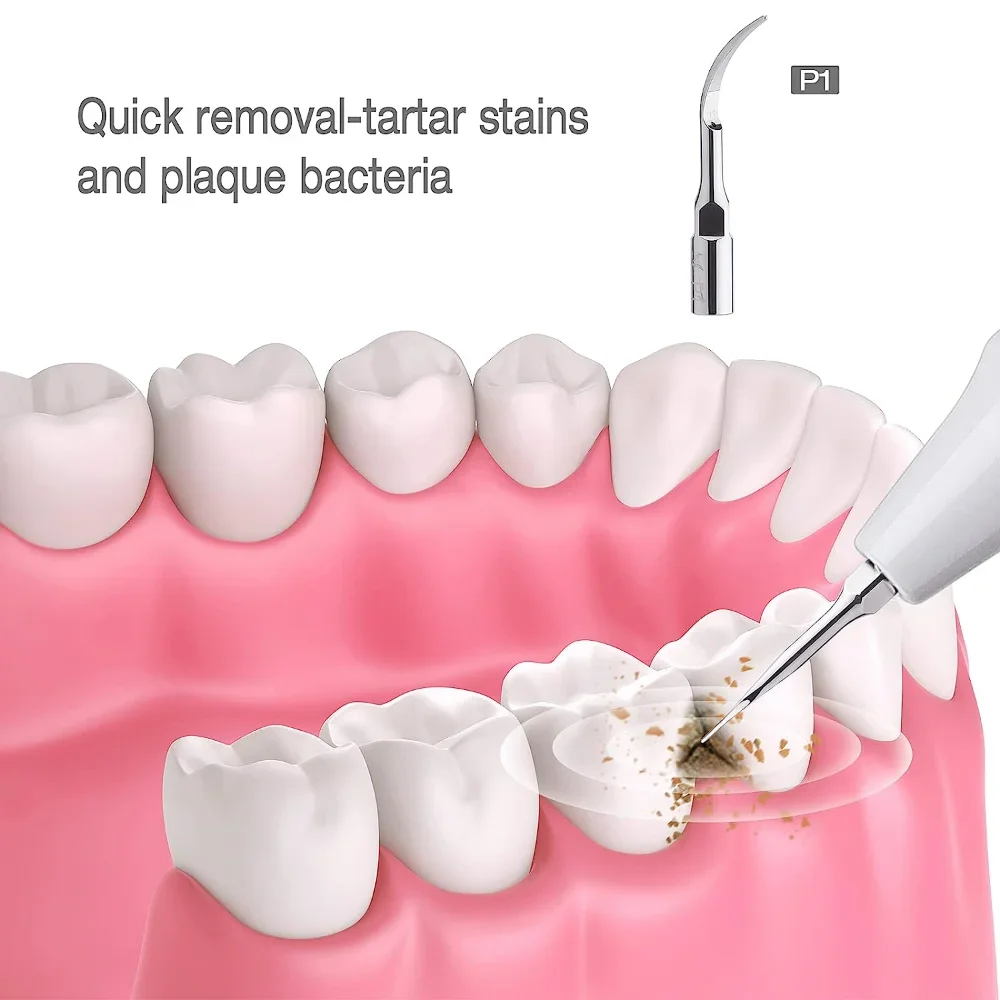 ELIJAH Dental Sugragingival Sc - مراجعة Thermal Paste وسعره