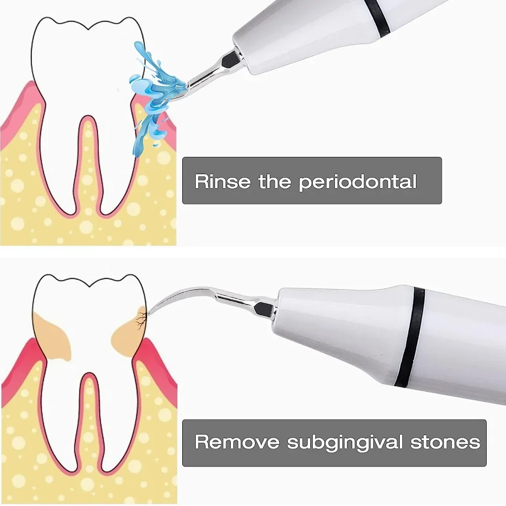 ELIJAH Dental Sugragingival Sc - مراجعة Thermal Paste وسعره